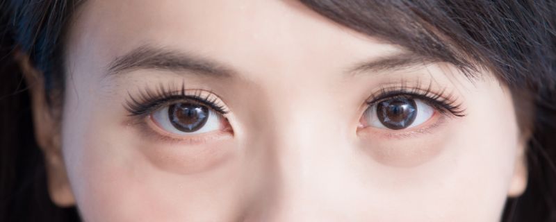 去眼袋的小方法 第1张